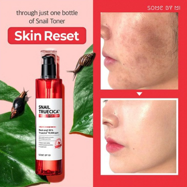 SOME BY MI Snail Truecica Miracle Repair Face Toner 150ml - Hydrating Korean Skincare Treatment