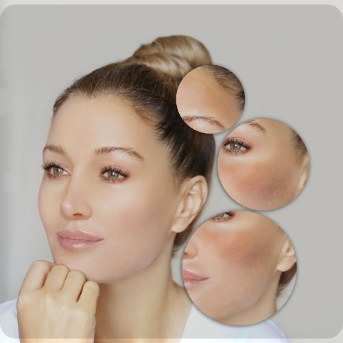 Dark Spots & Hyperpigmentation