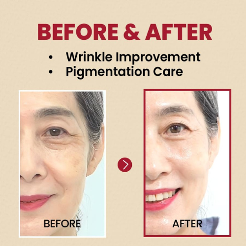 SEOUL 1988 Retinal Liposome 2% Black Ginseng Serum | Korean India