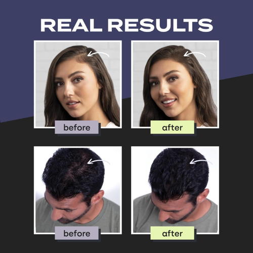 Toppik Hair Building Fibers - Black
