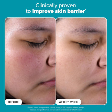 Paula’s Choice Perfecting 2% BHA Liquid Exfoliant – 118ml | Salicylic Acid for Blackheads & Pores