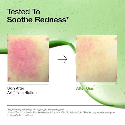 Anua Azelaic Acid 10+ Hyaluronic Redness Soothing Serum (30 ml)