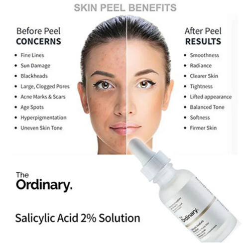 The Ordinary Salicylic Acid 2% solution (30 ml)